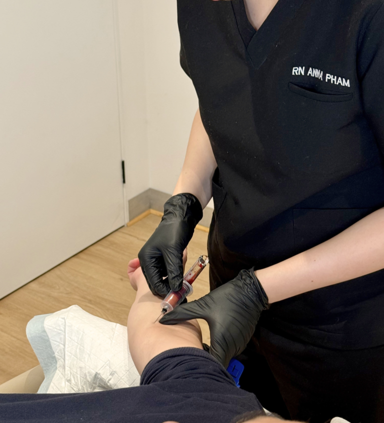 PRF treatment image for platelet-rich fibrin skin consultation